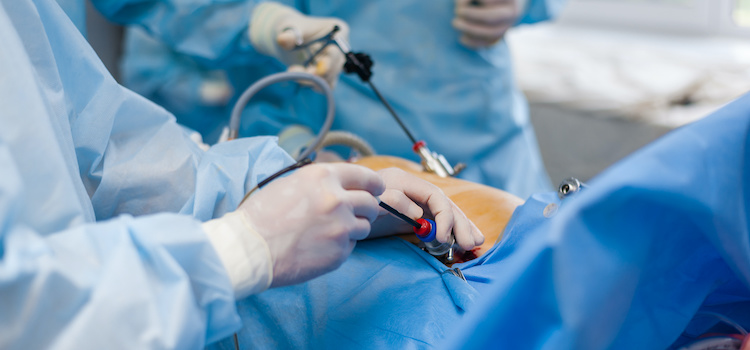 health connection, cirugía, general, hernia hiatal