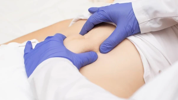 health connection, cirugía, general, hernioplastia umbilical