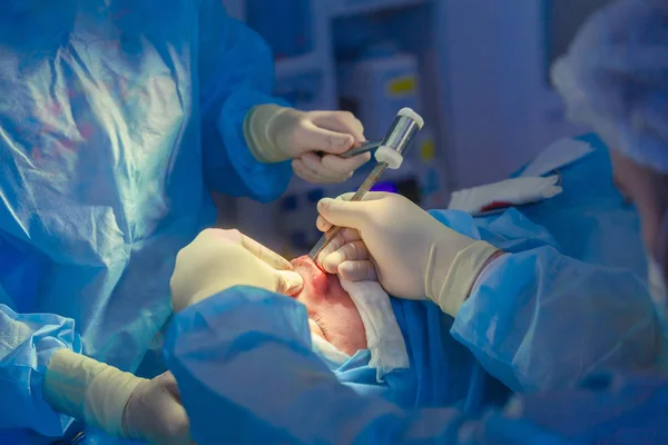 health connection, cirugía, otorrinolaringología, rinoseptumplastía
