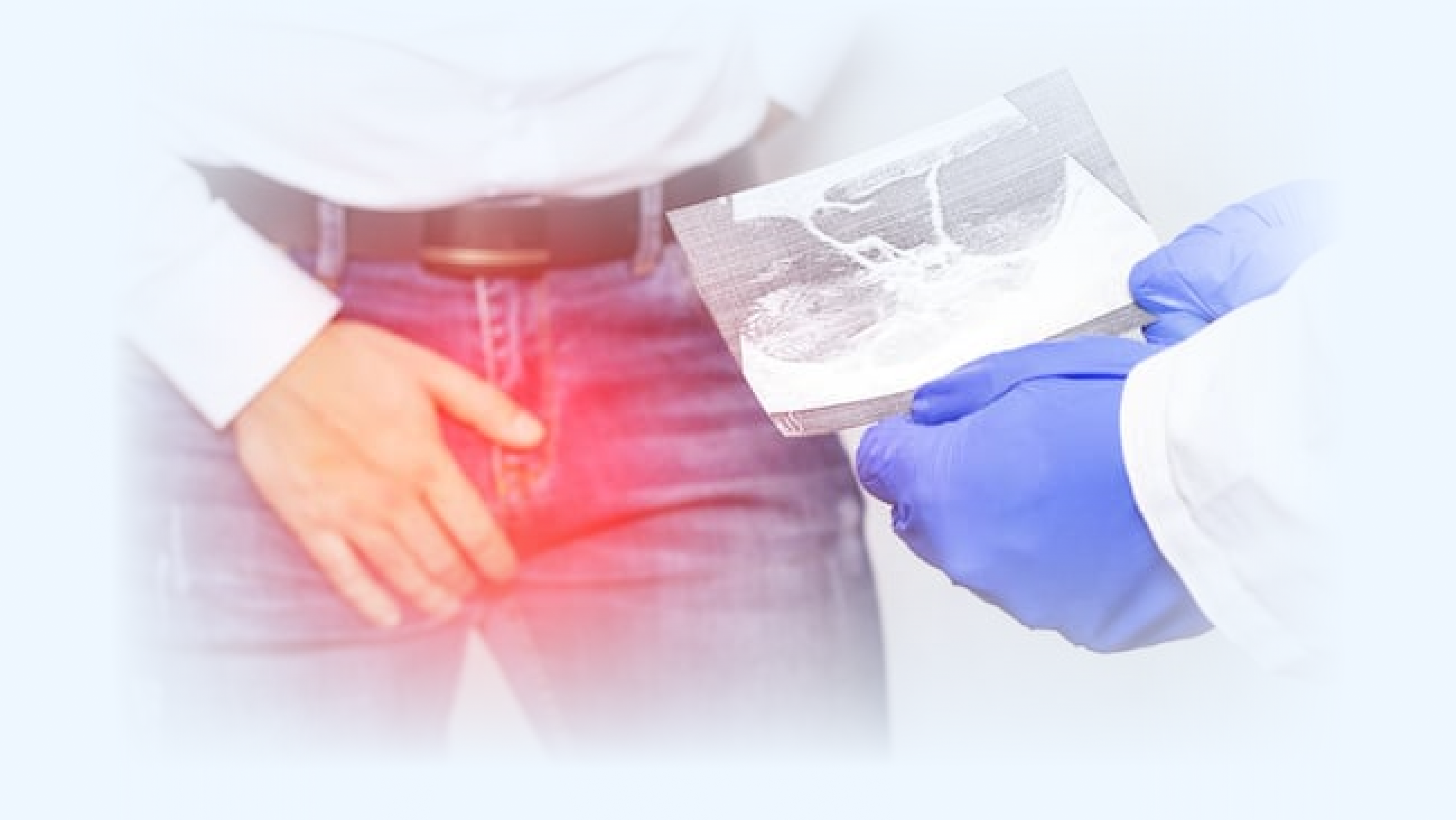 health connection, cirugía, general, urología, varicocele